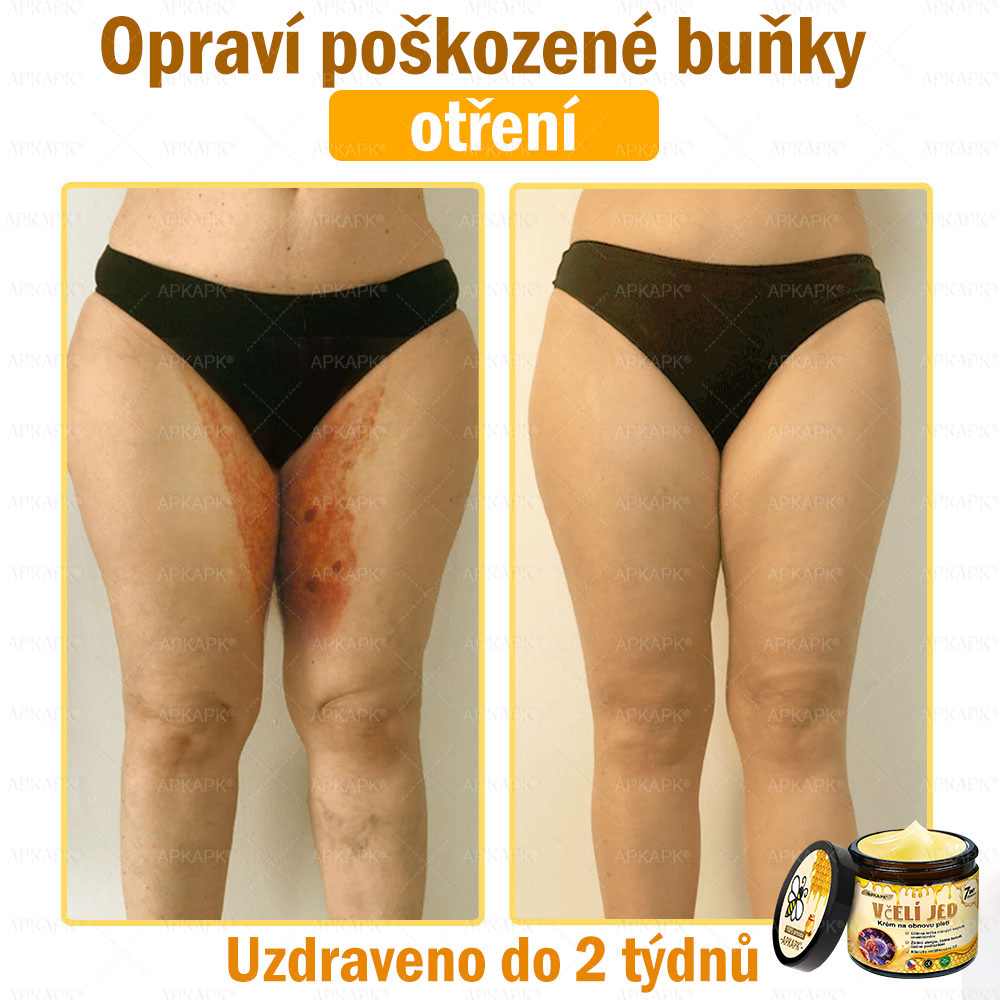🐝Dermatologicky a klinicky testováno👩‍⚕️🐝APK®Bee Venom Krém na obnovení pleti🐝 pomáhá při léčbě kožních problémů, jako jsou: vrásky, jizvy, pigmentové skvrny, strie, akné, psoriáza, ekzém, kožní změny, podráždění, záněty a další kožní problémy.