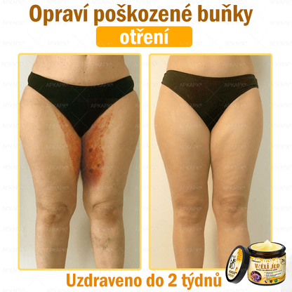 🐝Dermatologicky a klinicky testováno👩‍⚕️🐝APK®Bee Venom Krém na obnovení pleti🐝 pomáhá při léčbě kožních problémů, jako jsou: vrásky, jizvy, pigmentové skvrny, strie, akné, psoriáza, ekzém, kožní změny, podráždění, záněty a další kožní problémy.