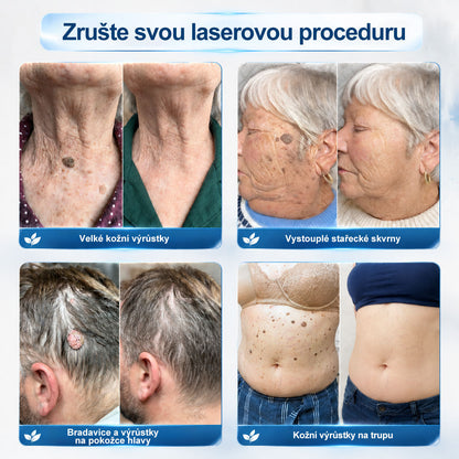 Oficiální značkový obchod🌷🌷 |🖊️𝐏𝐢𝐜𝑑𝑜® 𝟩𝖽𝖾𝗻𝗻í 𝘰𝘥𝘴𝘵𝗋𝖺ň𝗈𝗏𝖺č 𝒔𝒌𝒗𝒓𝙣 𝙖 𝙥𝙞𝙜𝙢𝙚𝙣𝙩𝘰𝘷ý𝘤𝘩 𝘴𝘬𝖛𝖗𝖓 (Bezbolestný rollerball bez jizev)