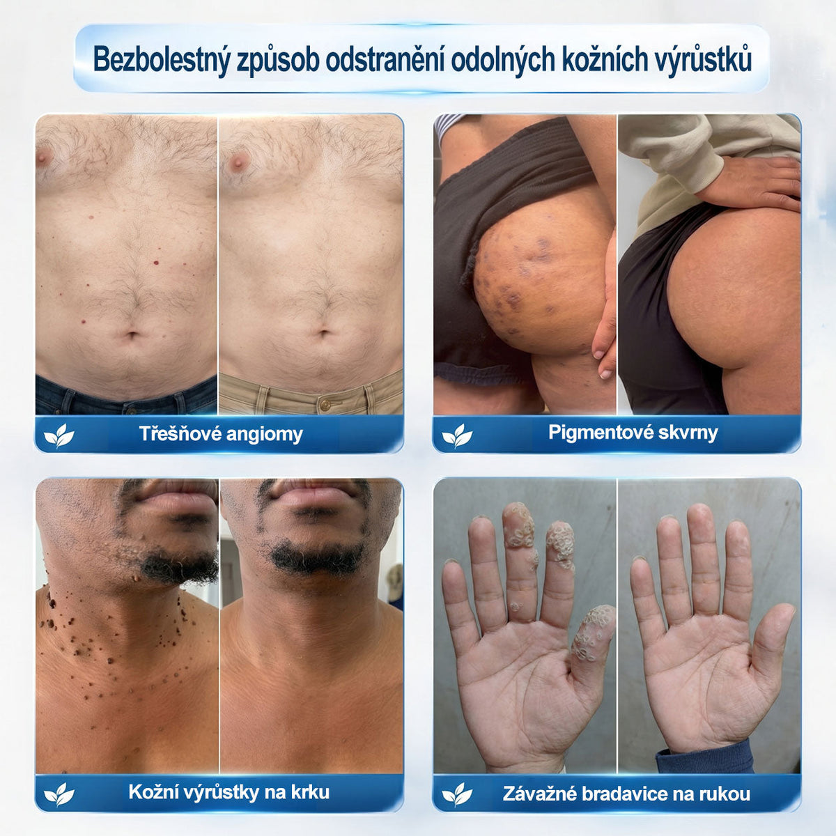 Oficiální značkový obchod🌷🌷 |🖊️𝐏𝐢𝐜𝑑𝑜® 𝟩𝖽𝖾𝗻𝗻í 𝘰𝘥𝘴𝘵𝗋𝖺ň𝗈𝗏𝖺č 𝒔𝒌𝒗𝒓𝙣 𝙖 𝙥𝙞𝙜𝙢𝙚𝙣𝙩𝘰𝘷ý𝘤𝘩 𝘴𝘬𝖛𝖗𝖓 (Bezbolestný rollerball bez jizev)