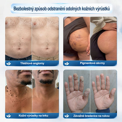 Oficiální značkový obchod🌷🌷 |🖊️𝐏𝐢𝐜𝑑𝑜® 𝟩𝖽𝖾𝗻𝗻í 𝘰𝘥𝘴𝘵𝗋𝖺ň𝗈𝗏𝖺č 𝒔𝒌𝒗𝒓𝙣 𝙖 𝙥𝙞𝙜𝙢𝙚𝙣𝙩𝘰𝘷ý𝘤𝘩 𝘴𝘬𝖛𝖗𝖓 (Bezbolestný rollerball bez jizev)