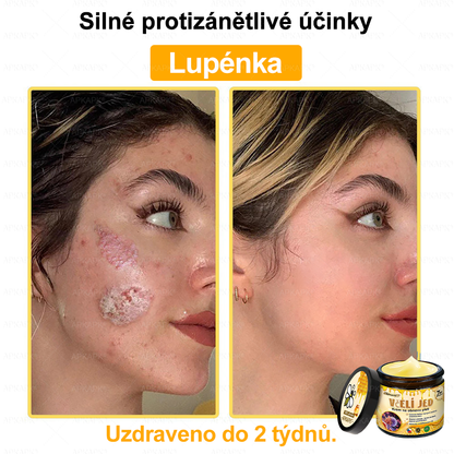 🐝Dermatologicky a klinicky testováno👩‍⚕️🐝APK®Bee Venom Krém na obnovení pleti🐝 pomáhá při léčbě kožních problémů, jako jsou: vrásky, jizvy, pigmentové skvrny, strie, akné, psoriáza, ekzém, kožní změny, podráždění, záněty a další kožní problémy.