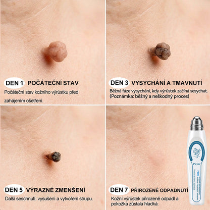 Oficiální značkový obchod🌷🌷 |🖊️𝐏𝐢𝐜𝑑𝑜® 𝟩𝖽𝖾𝗻𝗻í 𝘰𝘥𝘴𝘵𝗋𝖺ň𝗈𝗏𝖺č 𝒔𝒌𝒗𝒓𝙣 𝙖 𝙥𝙞𝙜𝙢𝙚𝙣𝙩𝘰𝘷ý𝘤𝘩 𝘴𝘬𝖛𝖗𝖓 (Bezbolestný rollerball bez jizev)