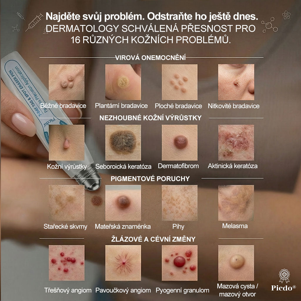 Oficiální značkový obchod🌷🌷 |🖊️𝐏𝐢𝐜𝑑𝑜® 𝟩𝖽𝖾𝗻𝗻í 𝘰𝘥𝘴𝘵𝗋𝖺ň𝗈𝗏𝖺č 𝒔𝒌𝒗𝒓𝙣 𝙖 𝙥𝙞𝙜𝙢𝙚𝙣𝙩𝘰𝘷ý𝘤𝘩 𝘴𝘬𝖛𝖗𝖓 (Bezbolestný rollerball bez jizev)