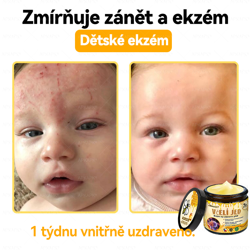 🐝Dermatologicky a klinicky testováno👩‍⚕️🐝APK®Bee Venom Krém na obnovení pleti🐝 pomáhá při léčbě kožních problémů, jako jsou: vrásky, jizvy, pigmentové skvrny, strie, akné, psoriáza, ekzém, kožní změny, podráždění, záněty a další kožní problémy.