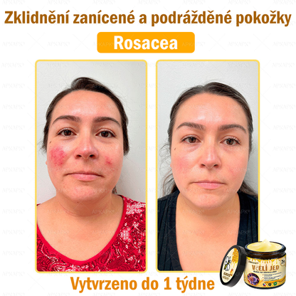 🐝Dermatologicky a klinicky testováno👩‍⚕️🐝APK®Bee Venom Krém na obnovení pleti🐝 pomáhá při léčbě kožních problémů, jako jsou: vrásky, jizvy, pigmentové skvrny, strie, akné, psoriáza, ekzém, kožní změny, podráždění, záněty a další kožní problémy.