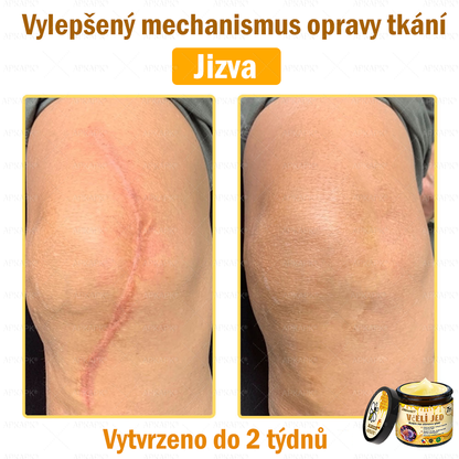 🐝Dermatologicky a klinicky testováno👩‍⚕️🐝APK®Bee Venom Krém na obnovení pleti🐝 pomáhá při léčbě kožních problémů, jako jsou: vrásky, jizvy, pigmentové skvrny, strie, akné, psoriáza, ekzém, kožní změny, podráždění, záněty a další kožní problémy.