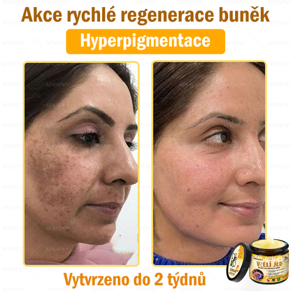 🐝Dermatologicky a klinicky testováno👩‍⚕️🐝APK®Bee Venom Krém na obnovení pleti🐝 pomáhá při léčbě kožních problémů, jako jsou: vrásky, jizvy, pigmentové skvrny, strie, akné, psoriáza, ekzém, kožní změny, podráždění, záněty a další kožní problémy.